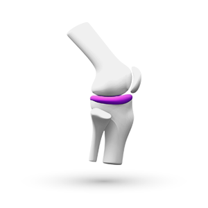 Dor / Osteoartrite